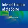Internal Fixation of the Spine (Original PDF from Publisher)