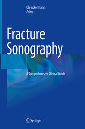 Fracture Sonography (Original PDF from Publisher)
