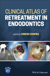 Clinical Atlas of Retreatment in Endodontics (Original PDF from Publisher)
