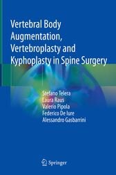 Vertebral Body Augmentation, Vertebroplasty and Kyphoplasty in Spine Surgery (Original PDF from Publisher)
