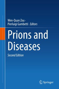 Prions and Diseases, 2nd Edition (EPUB)
