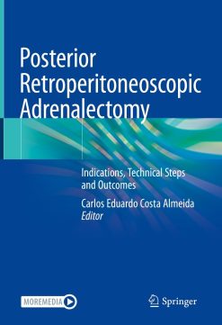 Posterior Retroperitoneoscopic Adrenalectomy (EPUB)