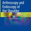Arthroscopy and Endoscopy of the Shoulder (Original PDF from Publisher)