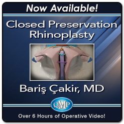 Closed Preservation Rhinoplasty 2023 (Videos)