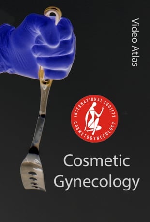 Video Atlas of Cosmetic Gynecology (Videos)