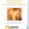 AIUM 3D Ultrasound of the Uterus and Adnexa: How Does it Make a Difference? (Videos)