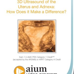 AIUM 3D Ultrasound of the Uterus and Adnexa: How Does it Make a Difference? (Videos)