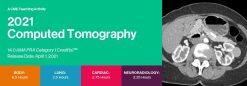 Computed Tomography (CT) 2021: National Symposium (Videos)