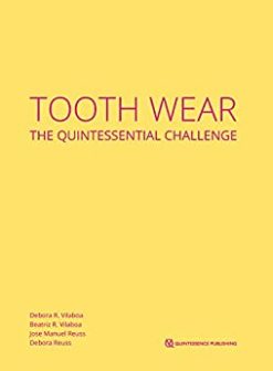Tooth Wear: The Quintessential Challenge (ePub+Converted PDF)