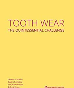 Tooth Wear: The Quintessential Challenge (ePub+Converted PDF)