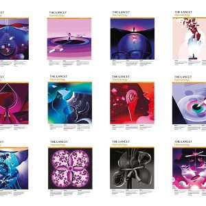 The Lancet Haematology 2023 Full Archives (True PDF)