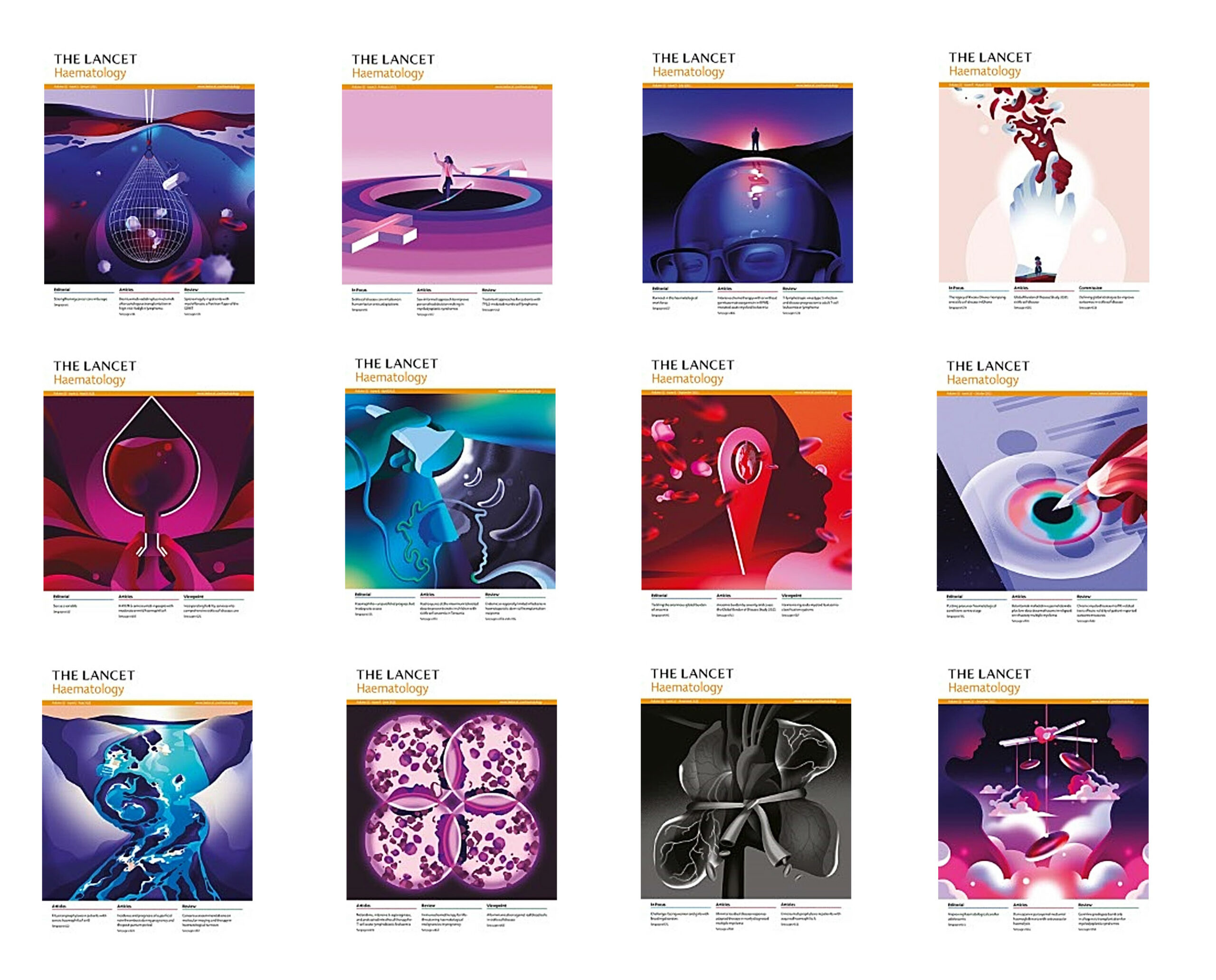 The Lancet Haematology 2023 Full Archives (True PDF)
