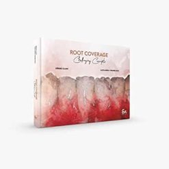 Root Coverage – Challenging Concepts (Original PDF from Publisher)