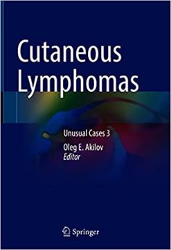 Cutaneous Lymphomas: Unusual Cases 3 (Original PDF from Publisher)
