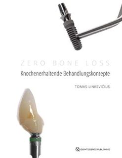 Zero Bone Loss: Knochenerhaltende Behandlungskonzepte (German Edition) (EPUB)