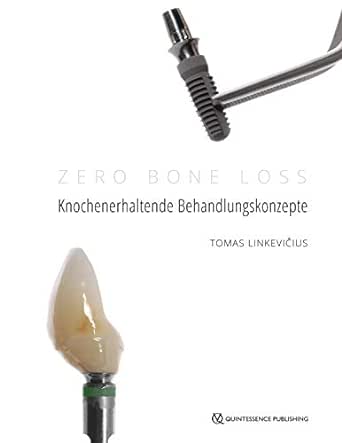 Zero Bone Loss: Knochenerhaltende Behandlungskonzepte (German Edition) (EPUB)
