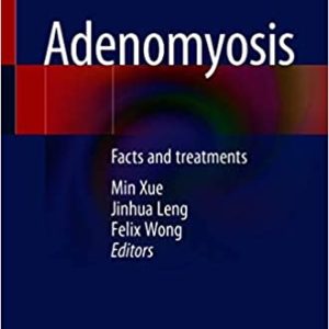 Adenomyosis: Facts and treatments (Original PDF from Publisher)