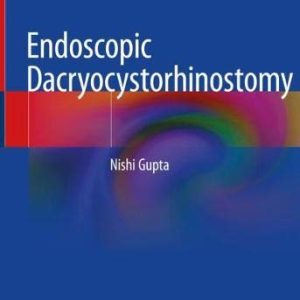 Endoscopic Dacryocystorhinostomy (Original PDF from Publisher)