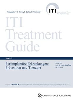 Periimplantäre Erkrankungen (ITI Treatment Guide Series) (German Edition) (EPUB)