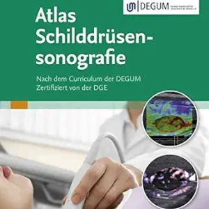 Atlas Schilddrüsensonografie (German Edition) (True PDF from Publisher)