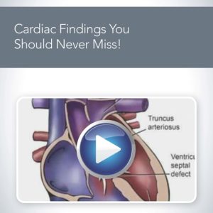 AIUM Cardiac Findings You Should Never Miss! (Videos)