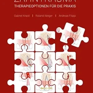 Zahntrauma: Therapieoptionen für die Praxis (German Edition) (EPUB)