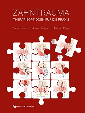 Zahntrauma: Therapieoptionen für die Praxis (German Edition) (EPUB)