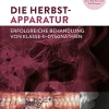 Die Herbst-Apparatur: Erfolgreiche Behandlung von Klasse-II-Dysgnathien (German Edition) (EPUB)