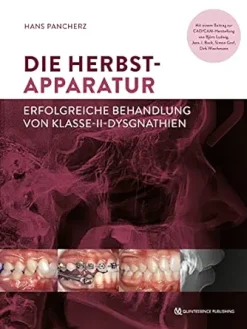 Die Herbst-Apparatur: Erfolgreiche Behandlung von Klasse-II-Dysgnathien (German Edition) (EPUB)
