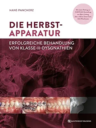 Die Herbst-Apparatur: Erfolgreiche Behandlung von Klasse-II-Dysgnathien (German Edition) (EPUB)