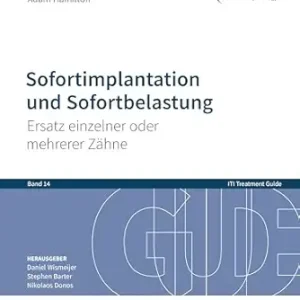 Sofortimplantation und Sofortbelastung: Ersatz einzelner oder mehrerer Zähne (ITI Treatment Guide 14) (German Edition) (Original PDF from Publisher)