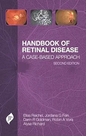 Handbook of Retinal Disease: A Case- Based Approach, 2ed (Original PDF from Publisher)