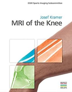 MRI of the Knee, 1st edition (Original PDF from Publisher)