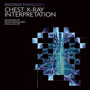 Discover Radiology Chest X-Ray Interpretation : Book for Medical Student (Original PDF from Publisher)