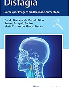 Disfagia: Exames por Imagem em Realidade Aumentada (EPUB)