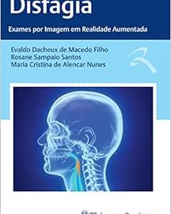 Disfagia: Exames por Imagem em Realidade Aumentada (EPUB)