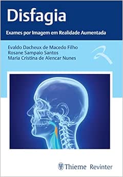Disfagia: Exames por Imagem em Realidade Aumentada (EPUB)