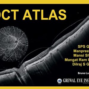 OCT Atlas (Original PDF from Publisher)