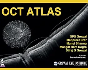 OCT Atlas (Original PDF from Publisher)