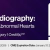 2026 Fetal Echocardiography: Normal and Abnormal Hearts (Videos)