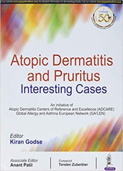 Atopic Dermatitis And Pruritus Interesting Cases (Original PDF From Publisher)