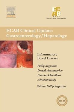 Inflammatory Bowel Diseases – ECAB (Original PDF from Publisher)