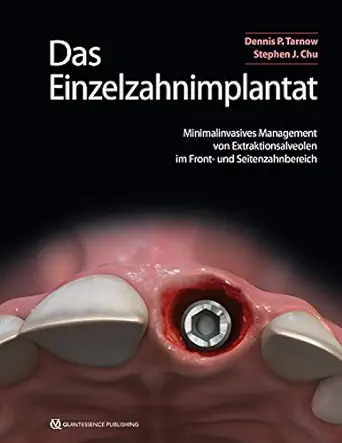 Das Einzelzahnimplantat: Minimalinvasives Management von Extraktionsalveolen im Front- und Seitenzahnbereich (German Edition) (EPUB)