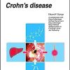 Ulcerative colitis – Crohn’s disease (UNI-MED Science) (Original PDF from Publisher)