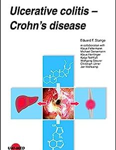 Ulcerative colitis – Crohn’s disease (UNI-MED Science) (Original PDF from Publisher)
