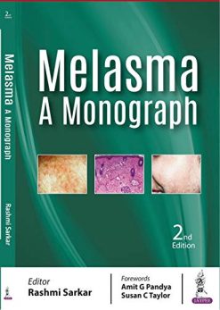 Melasma: A Monograph, 2nd Edition (Original PDF from Publisher)