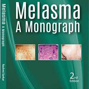 Melasma: A Monograph, 2nd Edition (Original PDF from Publisher)