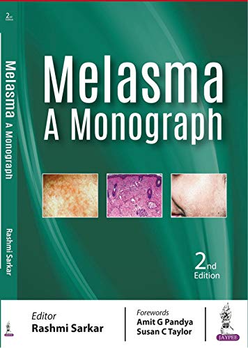 Melasma: A Monograph, 2nd Edition (Original PDF from Publisher)