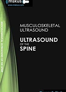 Ultrasound of the Spine, 2nd Edition (Original PDF from Publisher)