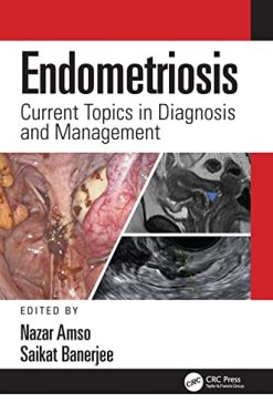 Endometriosis: Current Topics in Diagnosis and Management (Original PDF from Publisher)